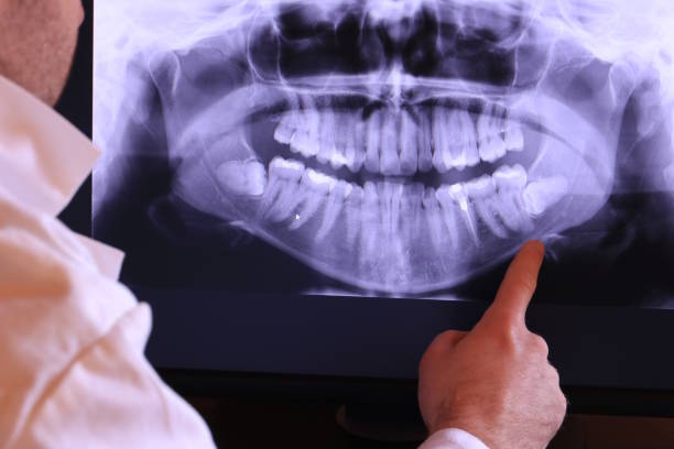 Best Broken or Chipped Tooth Repair in Lmerton, PA